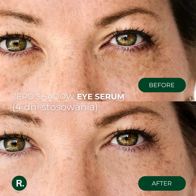 Ralls Zero Shadow Eye Serum - Serum pod oczy przeciw cieniom i obrzękom 20ml
