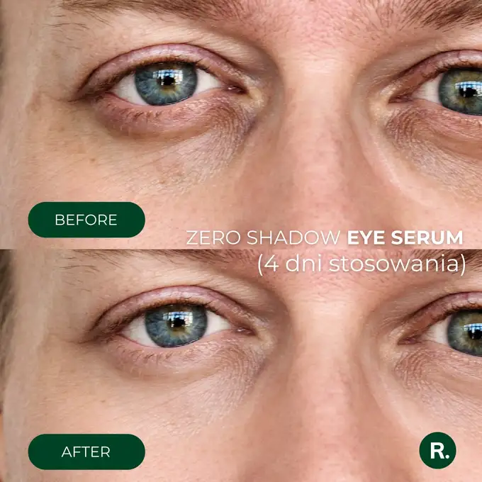 Ralls Zero Shadow Eye Serum - Serum pod oczy przeciw cieniom i obrzękom 20ml