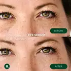 Ralls Zero Shadow Eye Serum - Serum pod oczy przeciw cieniom i obrzękom 20ml